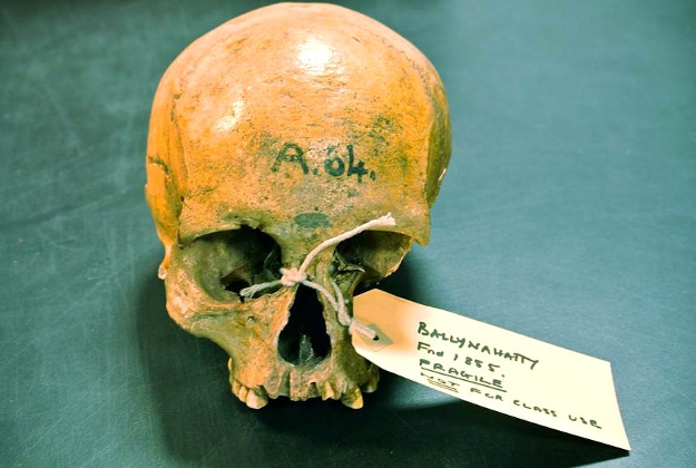 Photo issued by Trinity College Dublin of the skull of a farmer woman who lived near Belfast 5,200 years ago. The woman had ancestry that could be tracked to the Middle East, where agriculture was invented. 